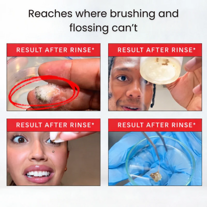 CelluMed iD Stain Mouthwash